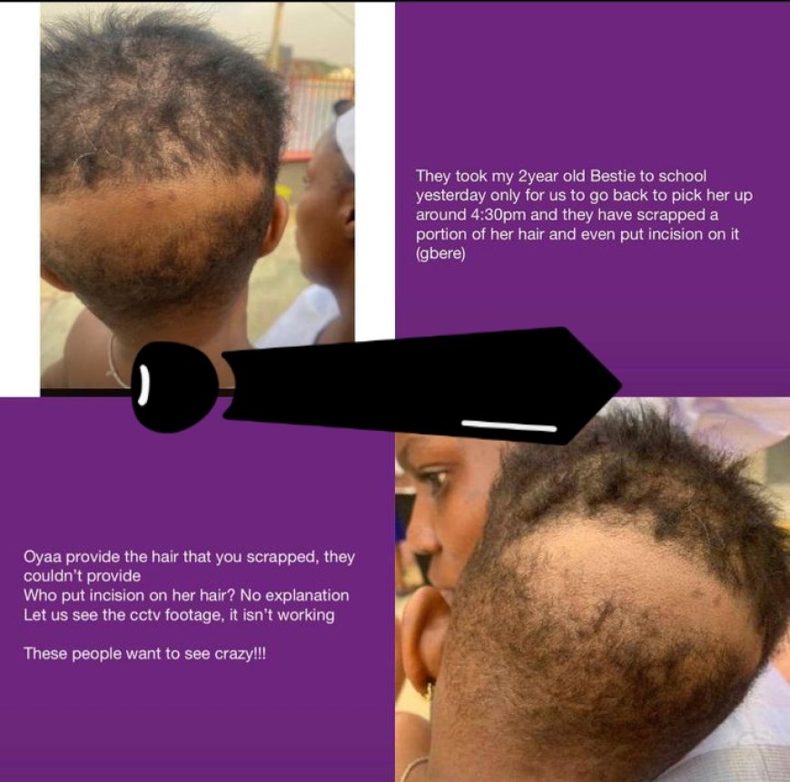 RITUALIST SCHOOL:  My 2years old baby hair was scrapped and incision was placed on her head.